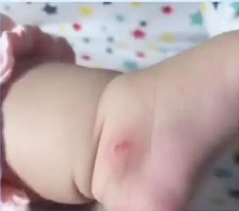 下手太狠！女婴在超市被陌生人抠掉脚皮！警方通报…