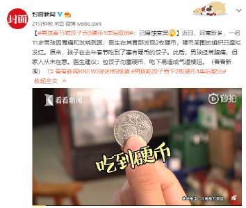 男孩春节吃饺子吞2枚硬币1年后取出：已腐蚀变黑
