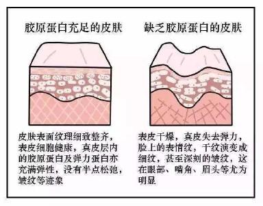 每10年就少1000克！补充胶原蛋白有没有用？