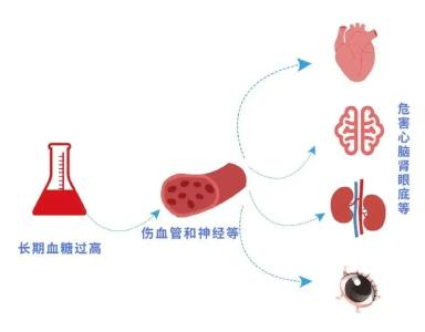 糖尿病人“酸到中毒”，咋回事？