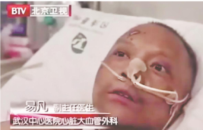 “黑脸”医生，白回来了！