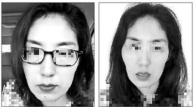 号称能瘦脸的徒手整骨是不是忽悠？
