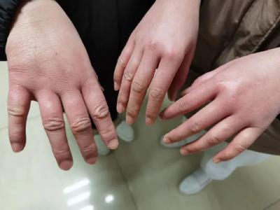 “馒头手”的主人，找到了！