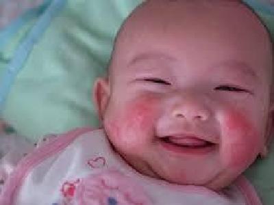 冬季寒冷干燥， 老年人和孩子是湿疹重灾区！