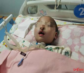 男童拔牙后昏迷40天，拔牙有风险？专家释疑