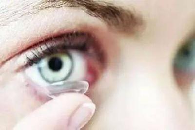 角膜塑形镜 并非所有近视患者都适合