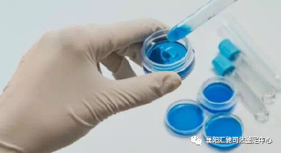 【司法鉴定】做司法鉴定，一般多久可以出结果？