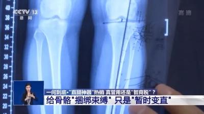 “直腿神器”热销！真管用还是“智商税”？