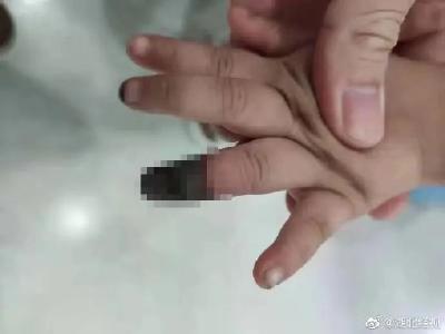 你被“偏方秘方”坑过吗？