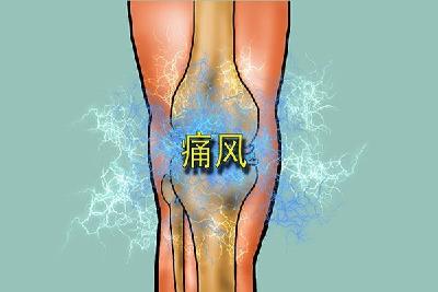 每日健康问答|尿酸水平高一定是痛风吗？
