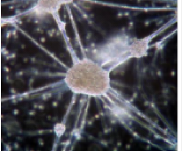 科学家研制体内精准给药微型游泳器