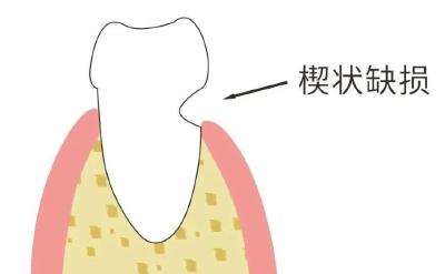 口腔健康关联全身 这份超实用牙齿清洁秘籍速存