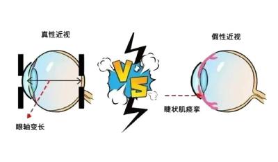 揭开眼睛的“骗局” 四招教你逆转假性近视 