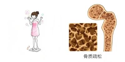 骨质疏松症早了解，别等骨折才重视｜世界骨质疏松日 