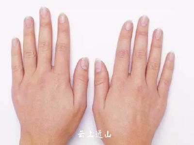 【健康】指甲上“小太阳”越多身体越好？不靠谱传闻太多了 