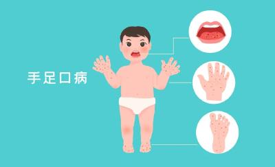 秋冬或出现手足口病小高峰 宝爸宝妈们快把预防方法学起