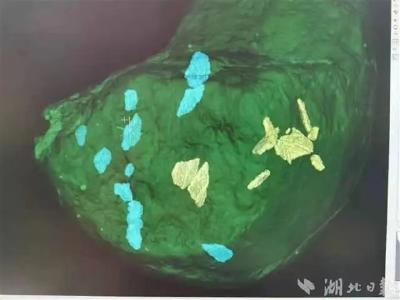 重大收获！湖北发现恐龙骨骼化石