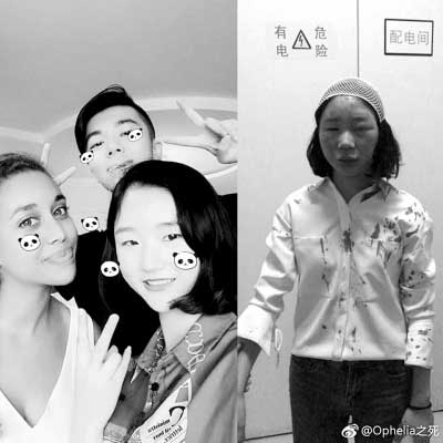 湖北|武汉女大学生昆明旅游遭袭击 当地警方介入调查