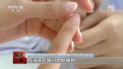女子美甲后指甲长出霉菌！记者调查美甲背后的隐患