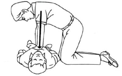 宋寄春医生，你救人的样子，真帅！