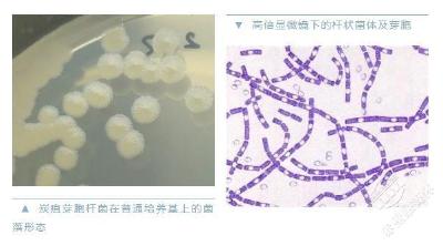 警惕炭疽，和新冠同一等级传染病！如何预防？