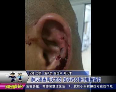 “醉汉”遇查两次冲岗  交警抓获时耳廓被撕裂