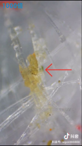 转给家人！原来把使用过的口罩放大1000倍是这样的