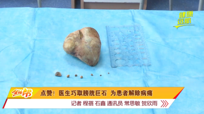 点赞！医生巧取膀胱巨石 为患者解除病痛