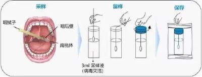 戳舌头，刮牙齿，捅喉咙，到底哪种才是正确的核酸采样方法？