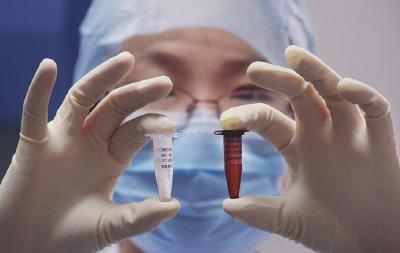 我市禽类未检出H7N9阳性市民可放心消费 