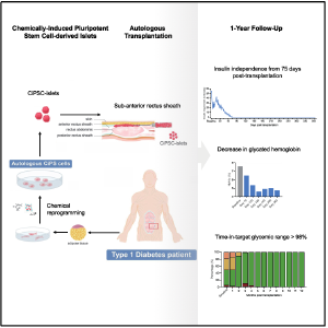 我国科学家首次利用干细胞再生疗法功能性治愈1型糖尿病 