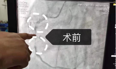 患者命悬一线，神农架、十堰两地医生接力与死神赛跑