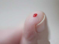 滴血测疾病 女子花4万买了本“基因天书”