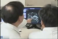 5岁娃脑子进了异物 医生抱着头“摇”了3小时