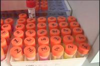 疾控部门多措并举 全力防控H7N9禽流感