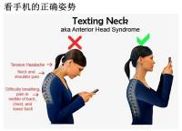 喜欢低头玩手机的亲注意了！你每天都在谋杀颈椎