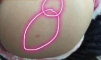 幼师被指针扎小孩 当事老师已被停课 