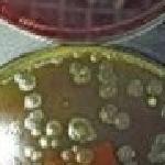 家中哪里细菌最多？不是厕所是厨房