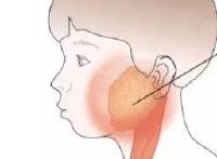 【健康】|流行性腮腺炎春夏多发 家长需注意观察提前预防