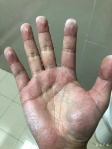 这双手——致敬战斗在防控一线的医务人员！