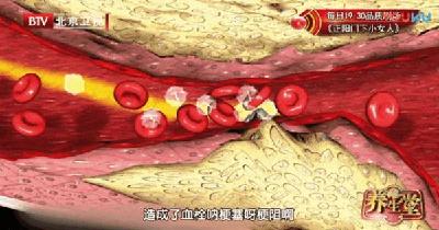  健康蔡甸 |“软化血管”骗了国人30年，而真相只有一个！