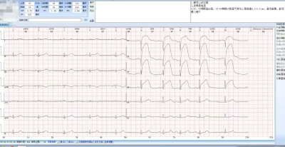 “心电一张网”  打通胸痛患者救治高速路