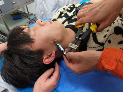 男子钓鱼甩钩不慎反“咬”脸 夷陵消防紧急救援解困