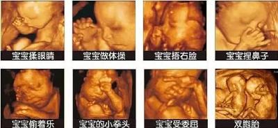 高清画质堪比IMAX大片，体验不一样的初恋 