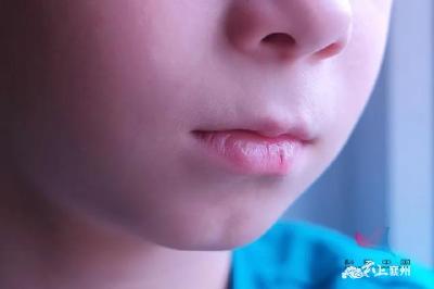 一到秋天，嘴唇就起皮？原来错了那么多年，润唇膏其实该竖着涂