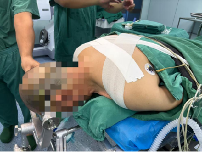 男子腰背疼痛一个月 脊柱竟藏有“不定时炸弹”