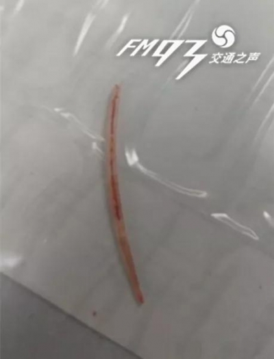 女子被鱼刺卡喉家人让她吞米饭 结果悲剧了
