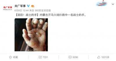 这只手的照片，让16万网友点赞，无数人心疼…