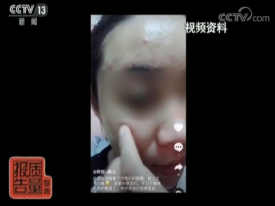 这些牌子的面膜竟然非法添加这种药！已有不少人的脸烂了…