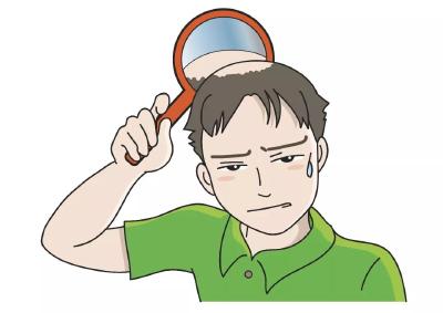 90后已经秃了？专家：不要太担心……